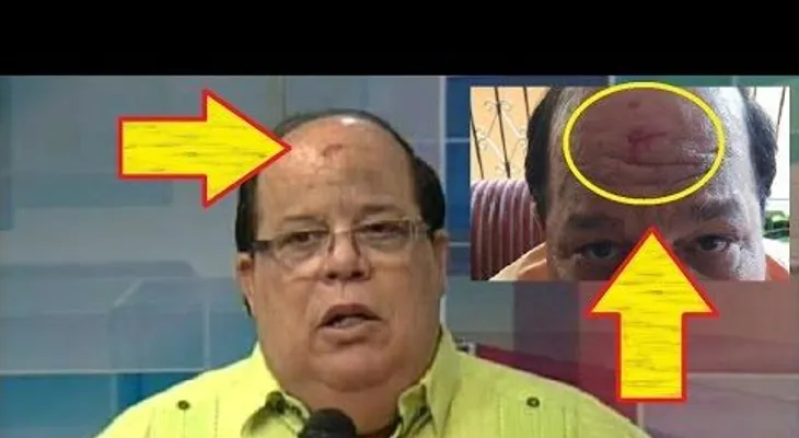 Abigaíl Soto narra cómo fue golpeado por Adolfo Salomón (VIDEO)