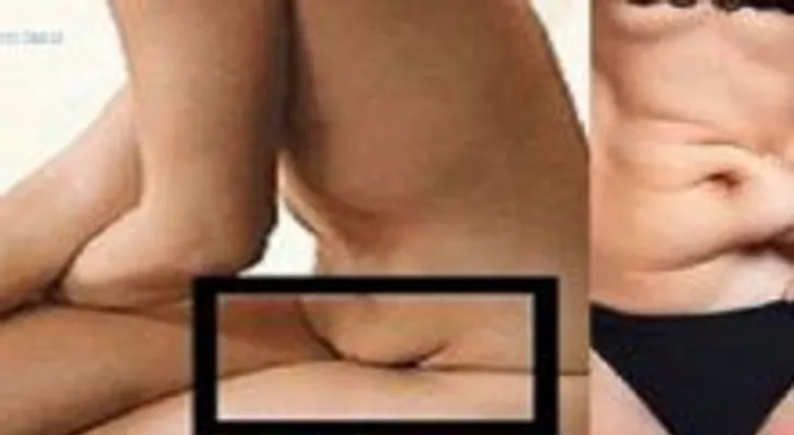 No tenga nunca más el vientre caído; consejos