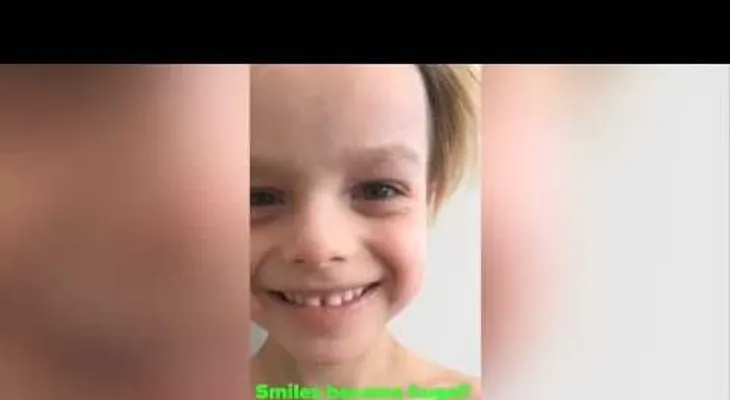 Ningún médico creía lo que le contaba de su hijo de años; lo graba y asombroso (VIDEO)