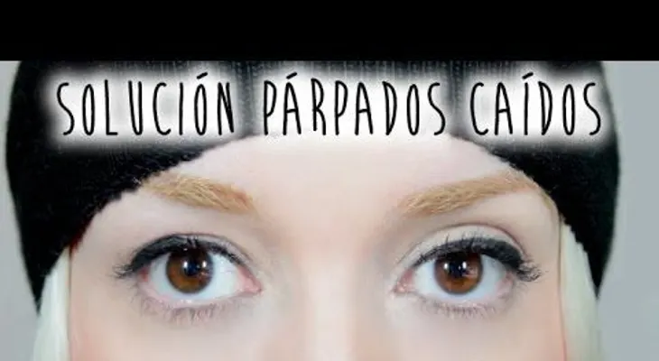 Soluciones para los párpados caídos sin necesidad de cirugía 
