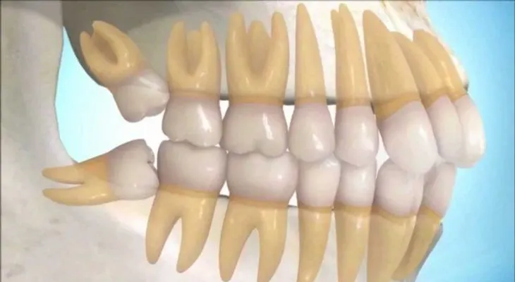 Esta es la estafa dental más grande de todos los tiempos: los odontólogos lo saben pero te dicen otra cosa. 