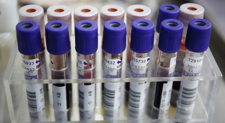 Una empresa de EE.UU. busca ganarle la carrera al cáncer con pruebas rápidas de ADN
