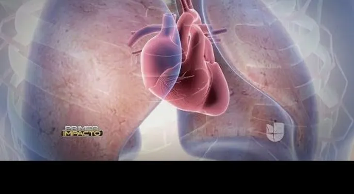 La hipertensión pulmonar una peligrosa enfermedad (VIDEO)