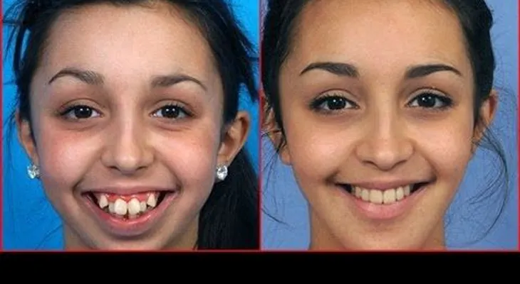 Jovencita luce impresionante tras varias cirugias (VIDEO)