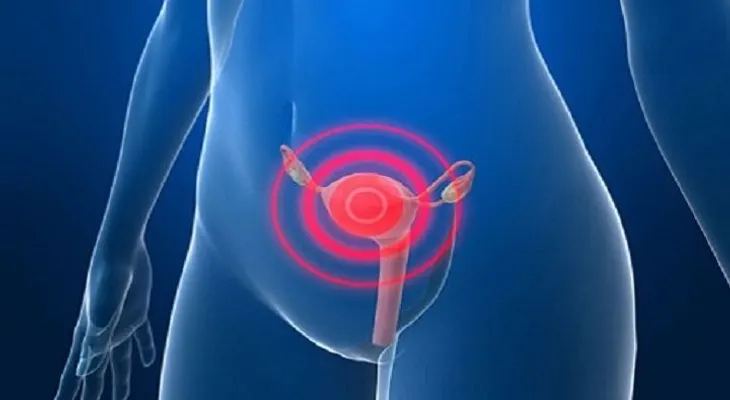 Los 7 factores que influyen en la aparición de un cáncer de útero