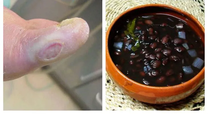 Farmacias han gastado millones de dólares para desaparecer esta receta! Conoce esta milenaria receta para tratar la Diabetes!!