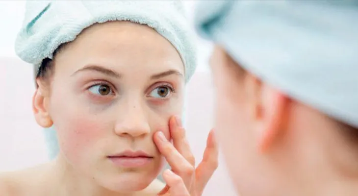 Ojeras y bolsas: ¿Por qué salen y cómo eliminarlas?