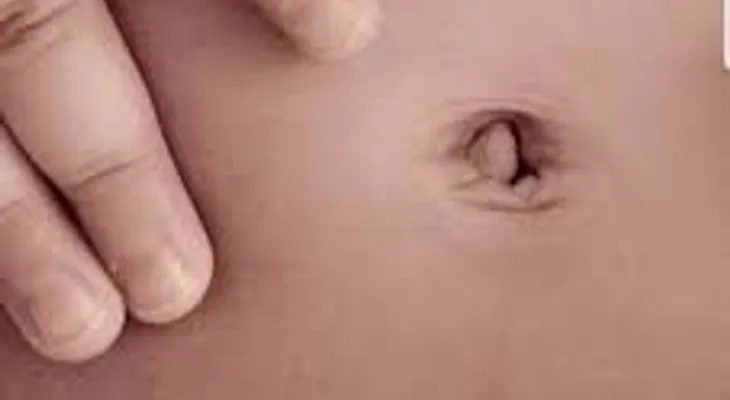 Ponerte aceite en el OMBLIGO? Muy interesante
