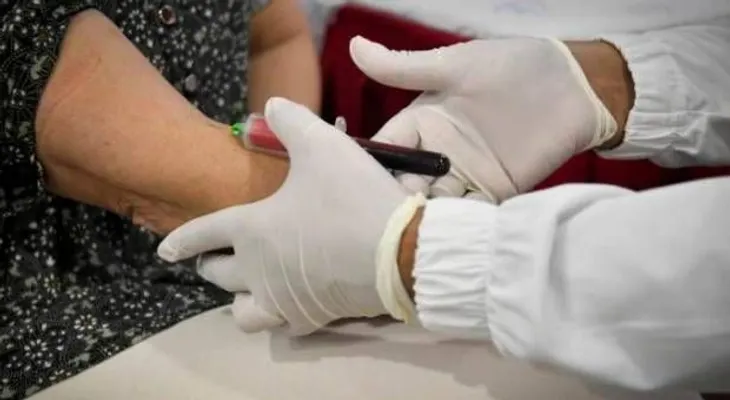 Tener sangre A se asocia a un 50% más de riesgo de sufrir un COVID-19 más severo