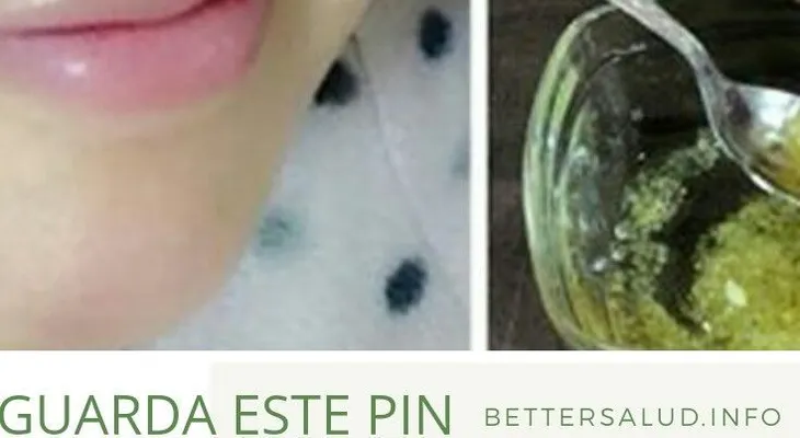 Para mujeres y hombres: Cómo usar el limón para quitar manchas de tu cara y tener una piel brillante