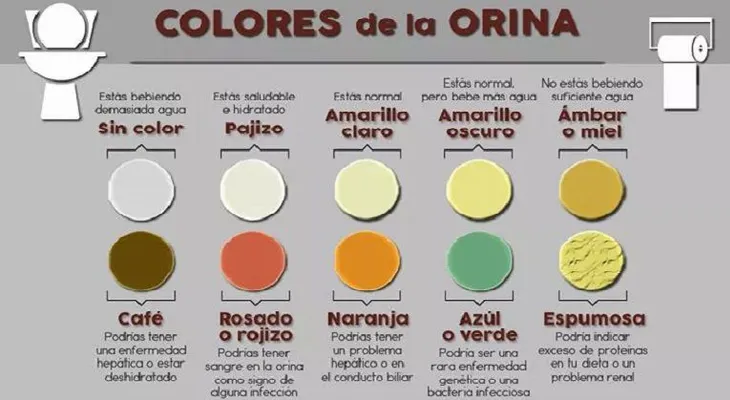 Claro; amarillo oscuro; marrón rojizo; naranja; azul: Colores de la orina y su significado