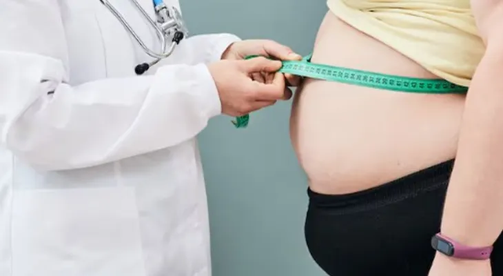 Obesidad afectará 40% del planeta en 2035