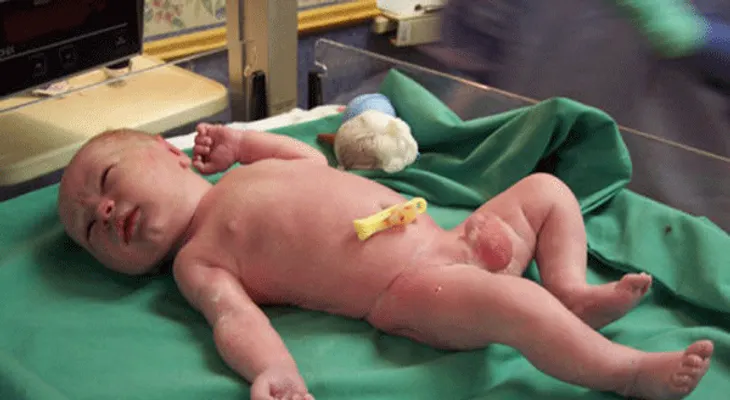 Pediatras advierten testículo no descendido provoca infertilidad
