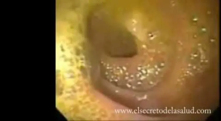¡Cuidado! si comes estos alimentos podrías contraer gusanos cerebrales (VIDEO)