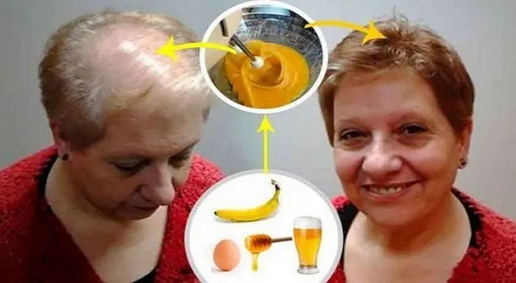 Truco para hacer crecer el cabello deja a todos los médicos con la boca abierta!!!