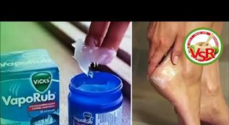 Sabías que el Vick Vaporub sirve para el pene y el ano