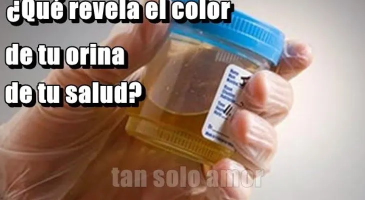 ¿Qué revela color de tu orina ?