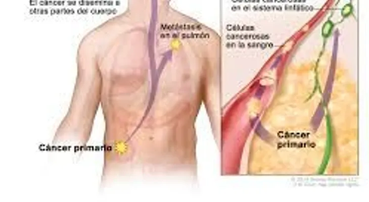 Científica Magdalena Paolino descubre cómo frenar metástasis del Cáncer