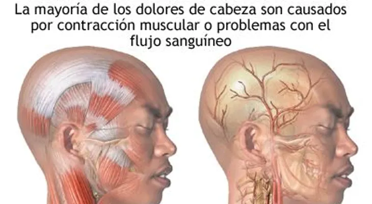 ¿Como solucionar, el dolor de cabeza constante?