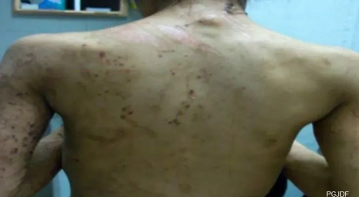 Un caso de esclavitud: Fue encadenada dos años para obligarla a planchar ropa día y noche
