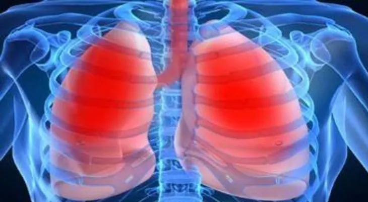La hipertensión pulmonar, una enfermedad grave, rara y de difícil diagnóstico
