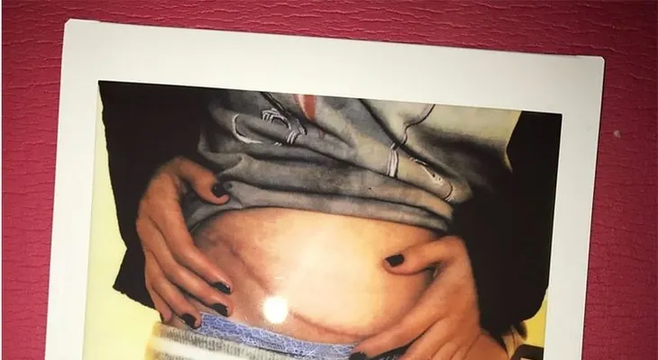 Raisa, la donante del riñón le reclama a Selena Gómez por su mala conducta; están distanciada