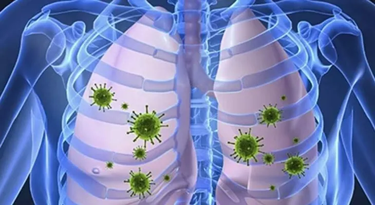 Suman 88 los muertos en Costa Rica a causa de virus respiratorios