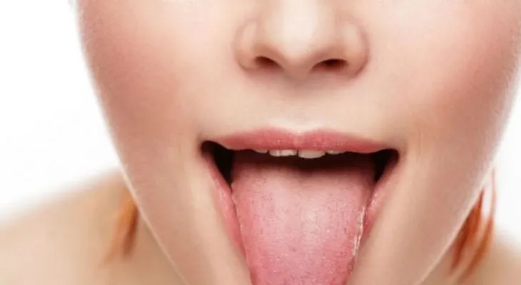 La lengua revela cómo está tu salud