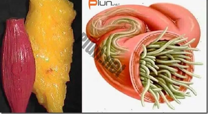 Con estos 2 ingredientes eliminé la grasa y parásitos de mi cuerpo como si nada