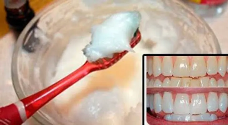 Termina con el mal aliento, el sarro y la placa con esta crema blanqueadora 