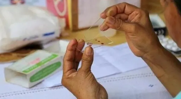El impacto de COVID-19 en sistemas de salud puede elevar muertes por VIH o malaria