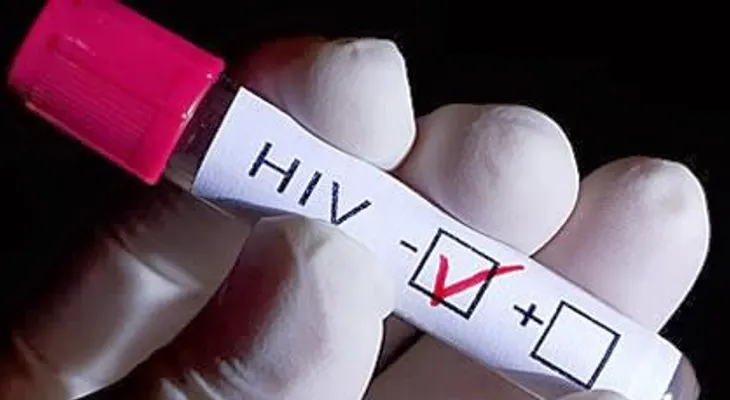 El lavado seminal permite que hombres con virus VIH tengan hijos sanos