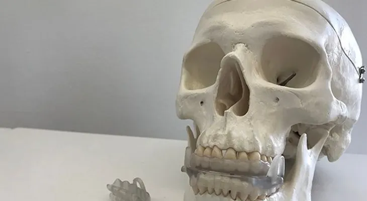Investigadores crean un dispositivo bucal que previene los ronquidos y la apnea del sueño