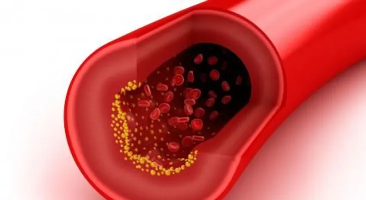 El colesterol bueno o HDL en la sangre no siempre es saludable para el corazón