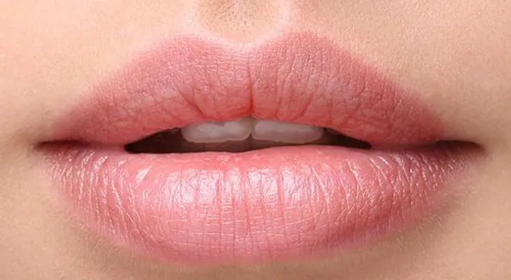 Soluciones para evitar los labios partidos 