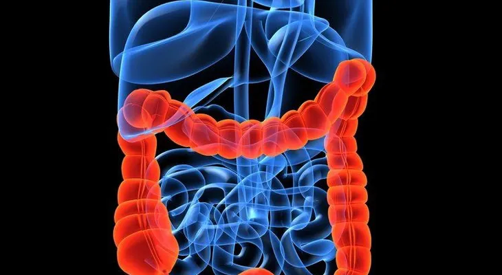 5 remedios naturales para limpiar el colon