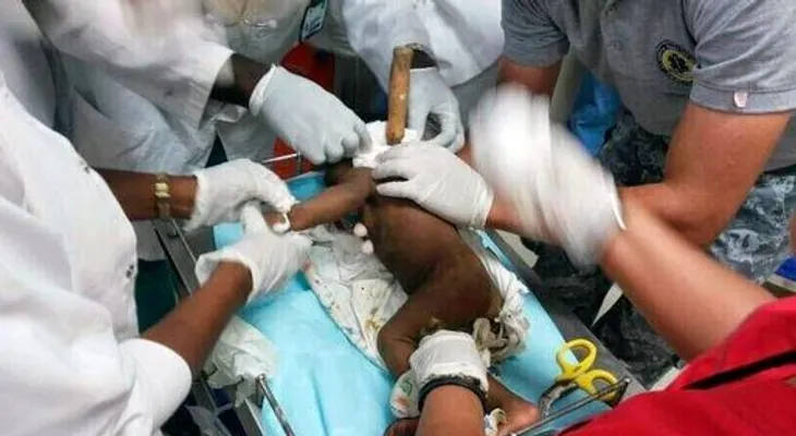 Muere haitiano que clavó punzón de picar hielo en el cuello de su hija de tres meses