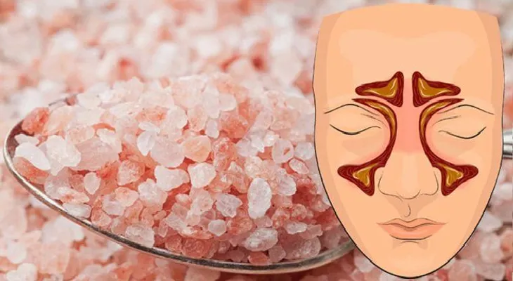 Usa sal del himalaya para aliviar infecciones sinusales y reducir el moco