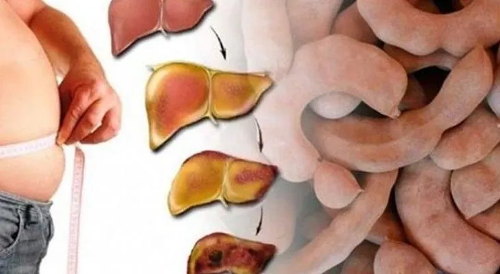 Si consume esta fruta el hígado graso desaparece por COMPLETO