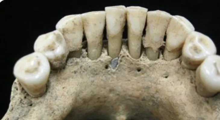 Pigmento azul en los dientes revela una cualidad de las mujeres medievales