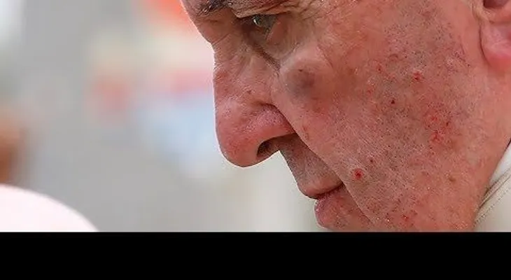 El papa Francisco se golpea el rostro en el papamóvil