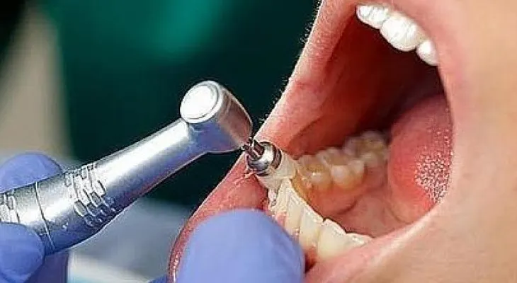 Personas con demencia tienen peor salud oral 