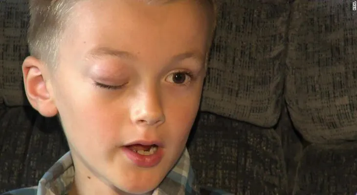 Niño que donó cabello para sobrevivientes de cáncer ahora tiene la misma enfermedad