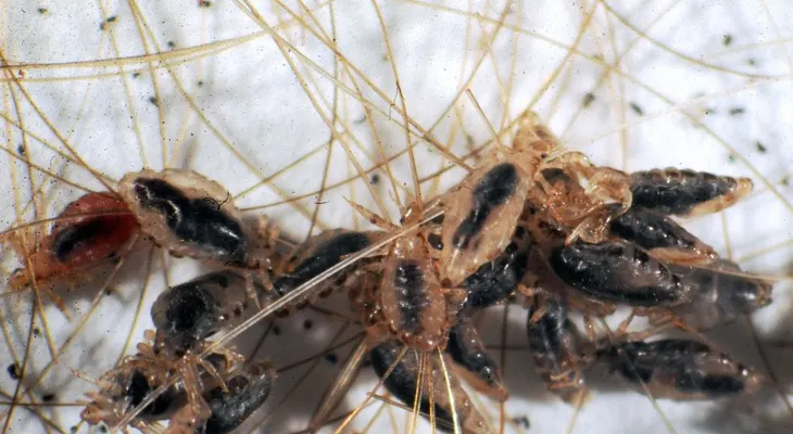 25 estados de EEUU invadidos por piojos mutantes resistentes a tratamientos