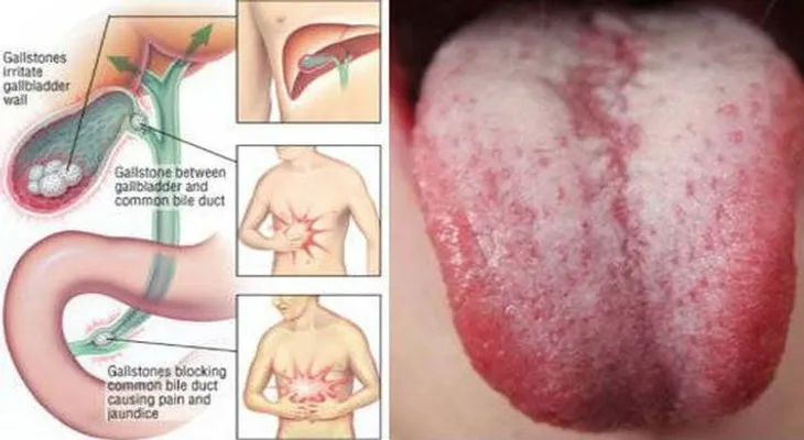 Necesitas eliminar las toxinas de tu cuerpo si notas estas señales de advertencia