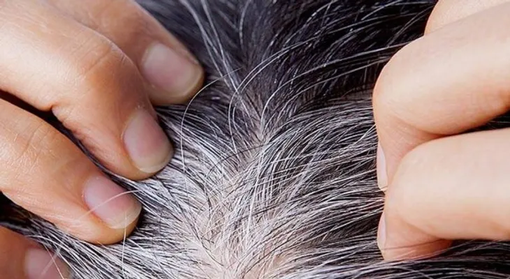 Descubre que las canas te salvan de un cáncer