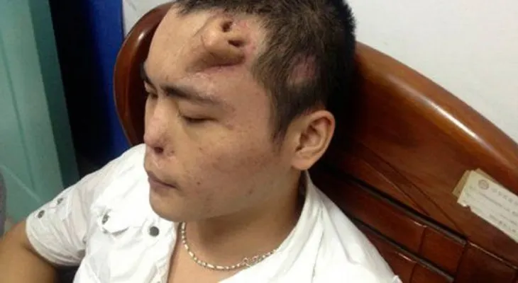 Mata a médico porque no le gustó el resultado de su operación de nariz 