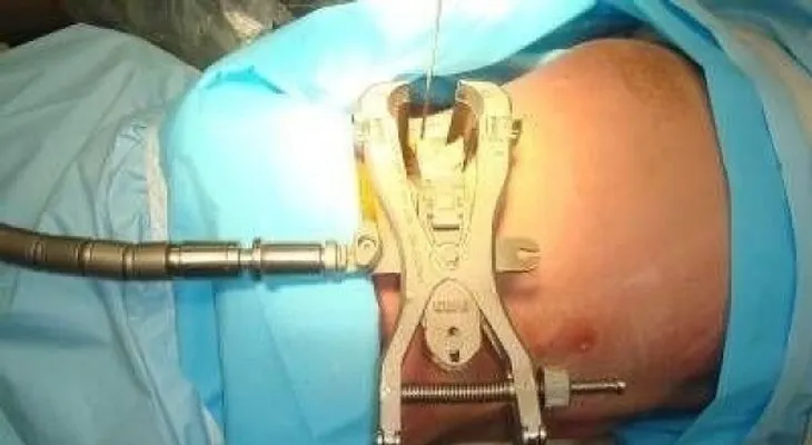 No es magia, es neurocirugía: hablamos con el doctor español que trata tumores inoperables