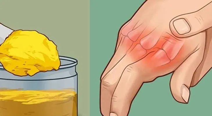 ¿Te duelen las manos y las articulaciones? Haz esto una sola vez y listo? !Dile adiós al dolor