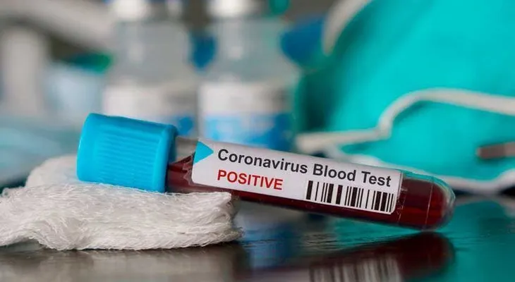 EEUU autoriza prueba de coronavirus da resultado en 45 minutos